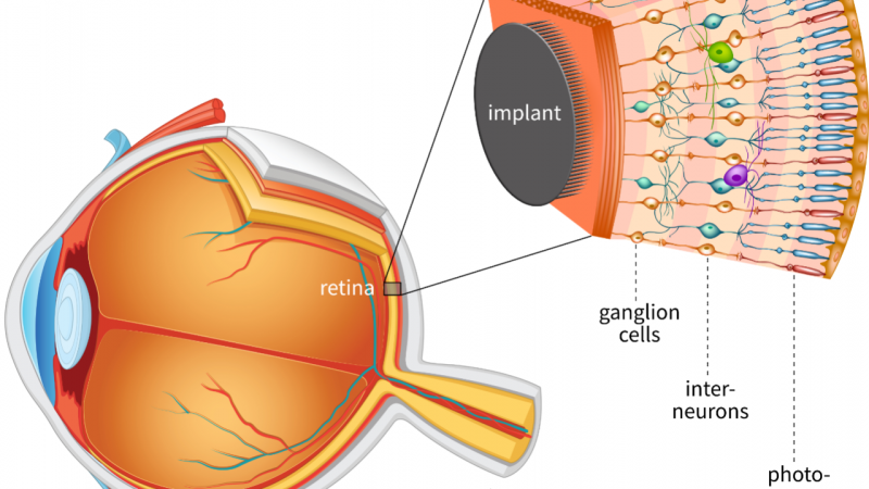 شبكية اصطناعية للعين تحدد من ترى ومن تتجاهل