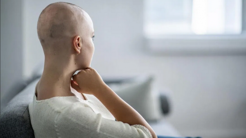 كيف تتعامل مع تساقط الشعر بسبب العلاج الكيميائي؟ - حقائق عن خسارة الشعر بسبب العلاج الكيماوي للسرطان، واستراتيجيات التعامل معها