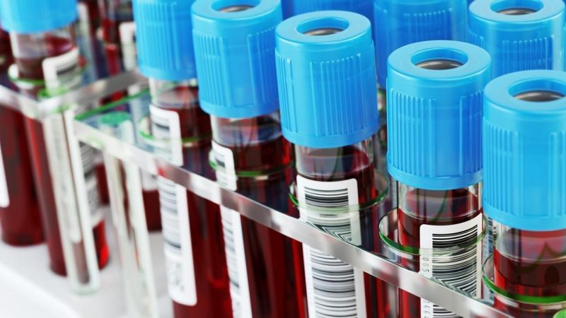 أنابيب الدم