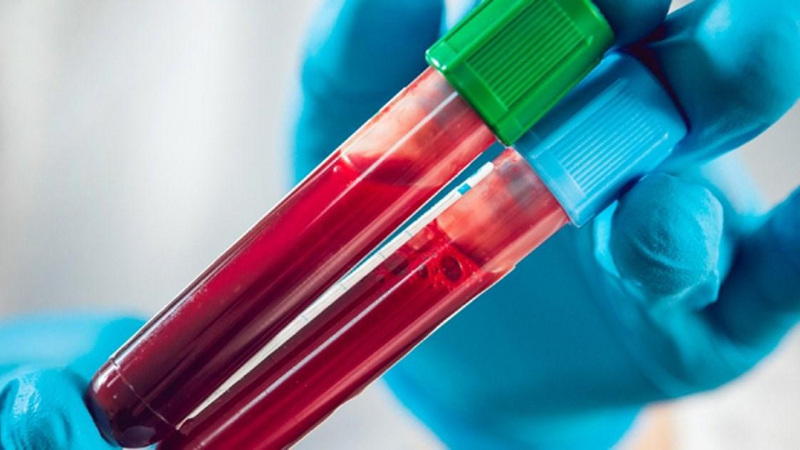 فصائل الدم والزواج