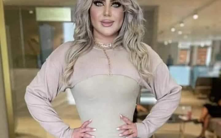 قامت ب ١٢ عملية تجميل و تؤكد "حبيت حالي اكتر بعد التجميل"