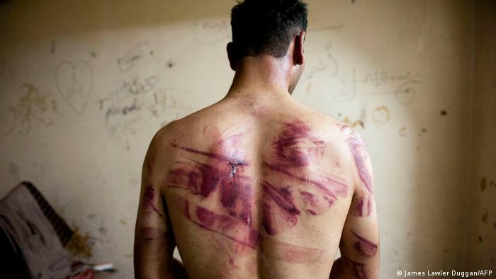 سوري تعرض للتعذيب (صورة رمزية)