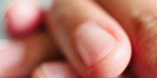 سبب تغير الوان الاظافر وعلاقتها بالأمراض
