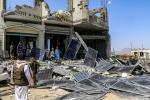 ولادة أول طفل في بريطانيا بعد عملية زرع رحم