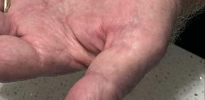 علماء يحذرون: مكمل شائع قد يلحق ضررا مضمرا بالقلب