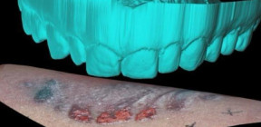 الأسنان ودورها في كشف الجرائم والكوارث الجماعية