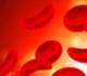 دراسة تكشف فصيلة الدم المرتبطة بارتفاع خطر الإصابة بسرطان البنكرياس بنسبة 72%